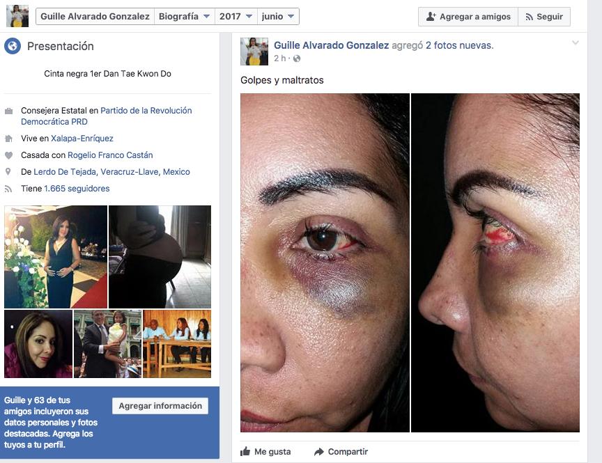 Publican supuestas fotos de esposa de Rogelio Franco, denuncian hackeo