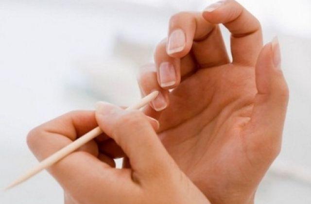 10 señales de tus uñas que te dicen si padeces alguna enfermedad