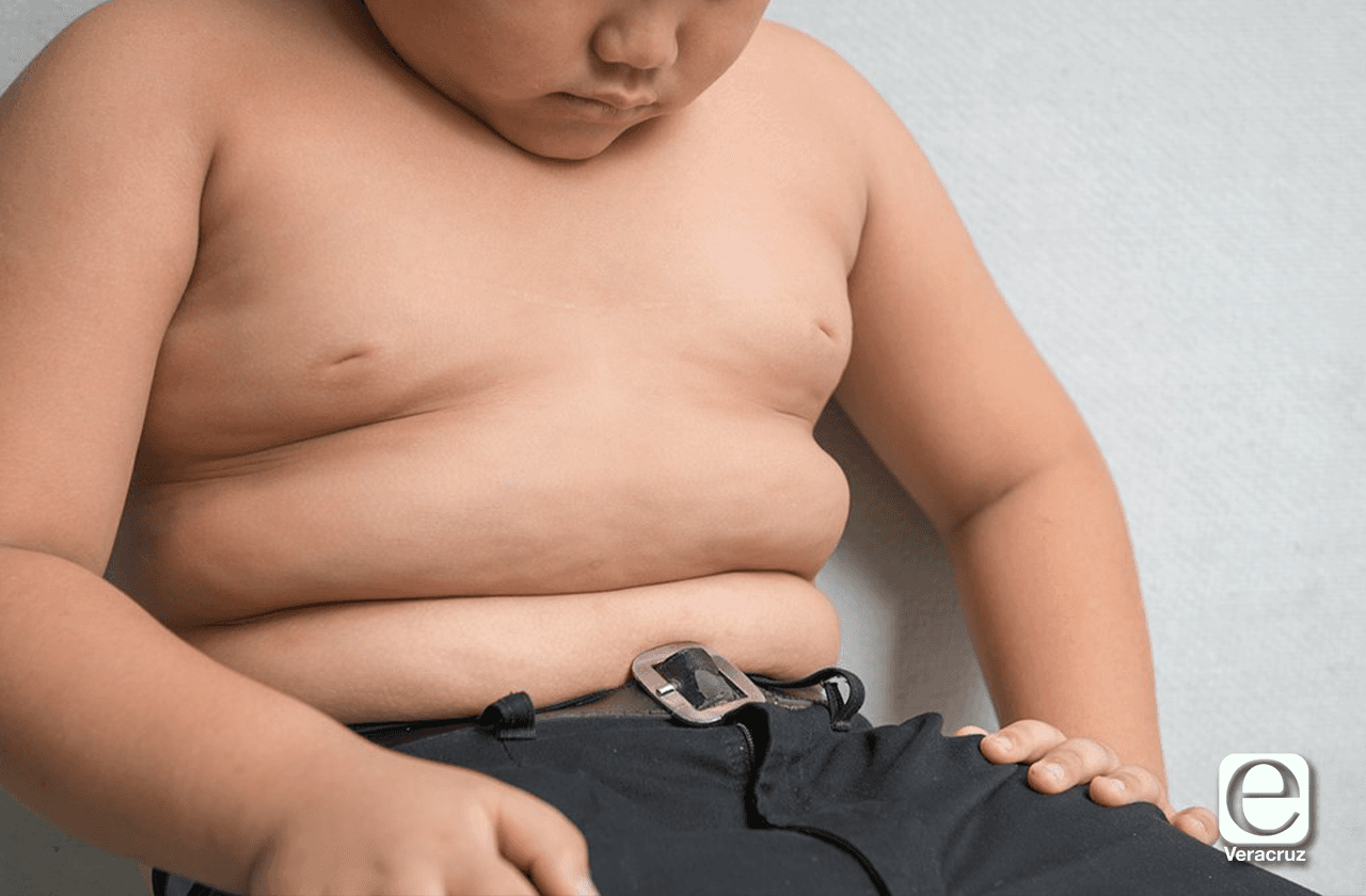 Aislamiento por covid-19 aumenta obesidad infantil 