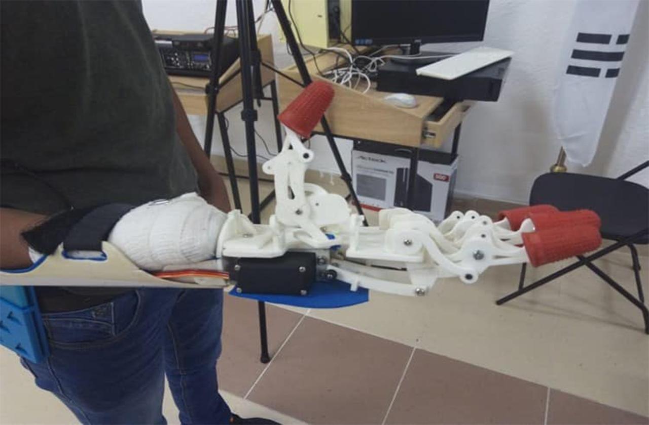 En Poza Rica diseñan prótesis a Alan, beisbolista que perdió una mano