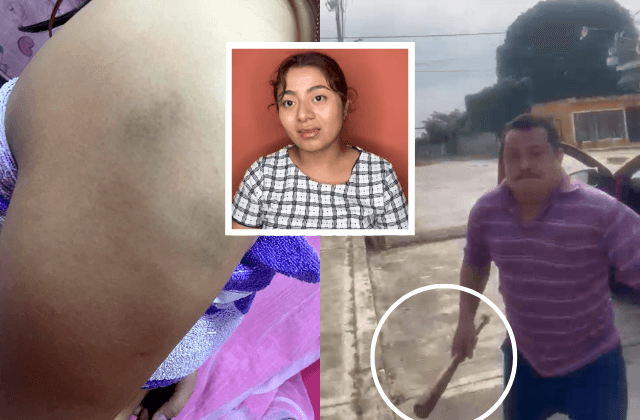VIDEO | Fanny denuncia a su padre en Soconusco por golpearla con bat