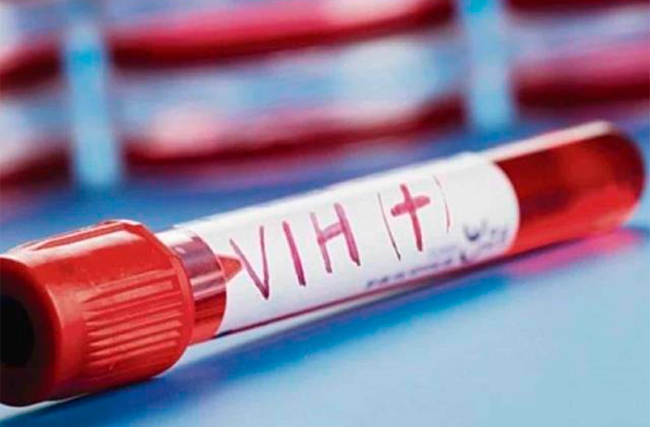 VIH/Sida avanza de forma silenciosa en el sur del estado 