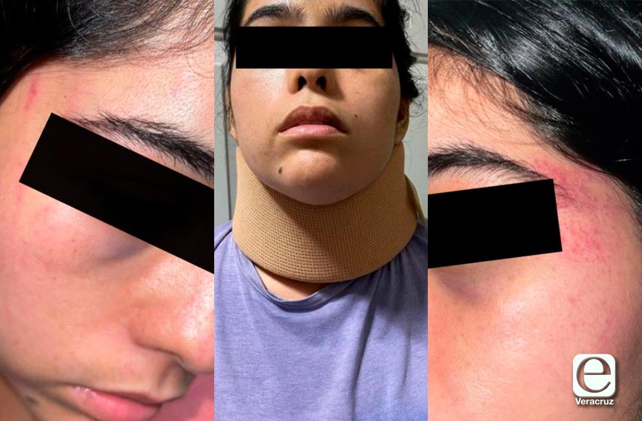 Quiso cortarme el cuello: Odalis, otro intento de feminicidio en Veracruz